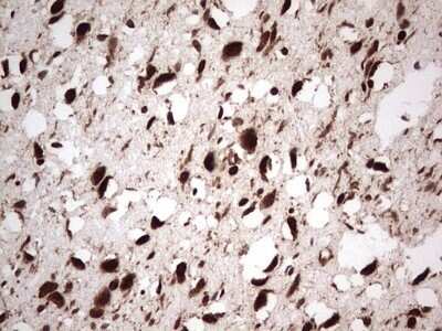 Immunohistochemistry: GLI-1 Antibody (OTI4E2) - Azide and BSA Free [NBP2-70831]