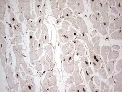 Immunohistochemistry: GLI-1 Antibody (OTI4E2) - Azide and BSA Free [NBP2-70831]