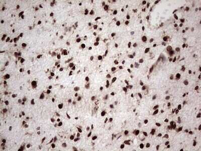 Immunohistochemistry: GLI-1 Antibody (OTI4E2) - Azide and BSA Free [NBP2-70831]