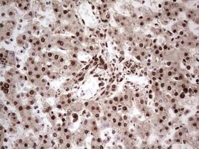 Immunohistochemistry: GLI-1 Antibody (OTI4E2) - Azide and BSA Free [NBP2-70831]