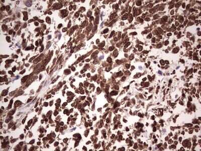 Immunohistochemistry: GLI-1 Antibody (OTI4E2) - Azide and BSA Free [NBP2-70831]