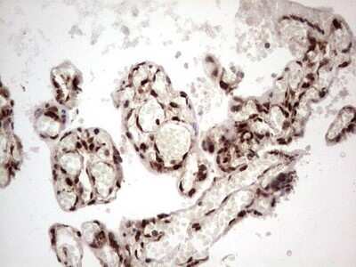 Immunohistochemistry: GLI-1 Antibody (OTI4E2) - Azide and BSA Free [NBP2-70831]