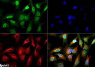 Immunocytochemistry/ Immunofluorescence: GLI-2 Antibody - BSA Free [NBP2-23602]