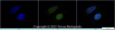 Immunocytochemistry/ Immunofluorescence: GLI-2 Antibody - BSA Free [NBP2-23602]