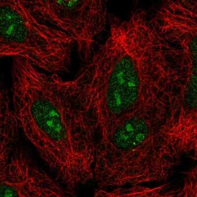 Immunocytochemistry/ Immunofluorescence: GLI-2 Antibody [NBP2-57535]