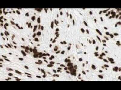 Immunohistochemistry: GLI-2 Antibody [NB600-874]