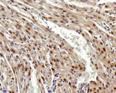 Immunohistochemistry: GLI-2 Antibody - BSA Free [NBP2-23602]