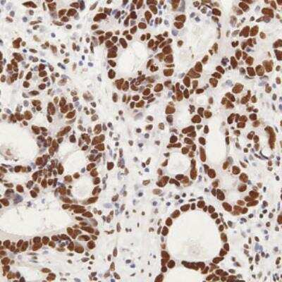 Immunohistochemistry-Paraffin: GLI-2 Antibody [NB600-874]