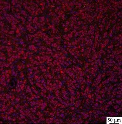 Immunohistochemistry-Paraffin: GLI-2 Antibody - BSA Free [NBP2-23602]