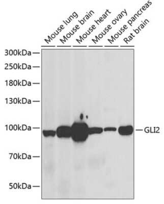 Western Blot: GLI-2 AntibodyBSA Free [NBP3-05613]