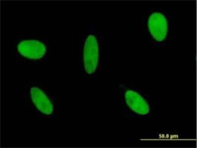 Immunocytochemistry/ Immunofluorescence: GLI-3 Antibody (2C9) [H00002737-M01]