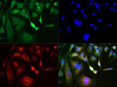 Immunocytochemistry/ Immunofluorescence: GLI-3 Antibody - BSA Free [NBP2-29627]