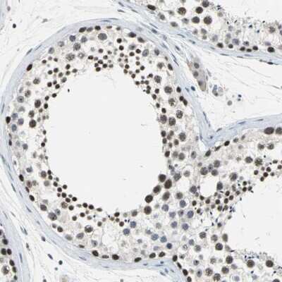 Immunohistochemistry-Paraffin: GLI-3 Antibody [NBP1-89275]