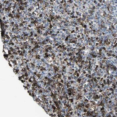 Immunohistochemistry-Paraffin: GLI-3 Antibody [NBP1-89275]