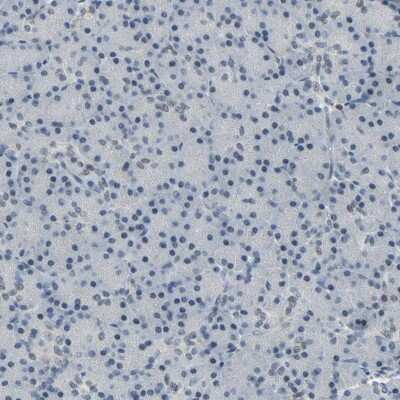 Immunohistochemistry-Paraffin: GLI-3 Antibody [NBP1-89275]