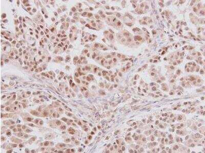 Immunohistochemistry-Paraffin: GLI-3 Antibody [NBP2-16665]