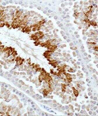 Immunohistochemistry-Paraffin: GLI-3 Antibody - BSA Free [NBP2-29627]