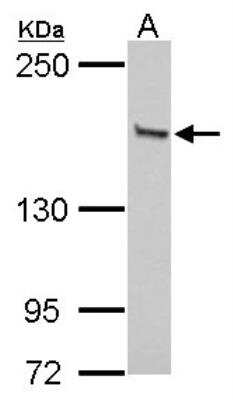 Western Blot: GLI-3 Antibody [NBP2-16665]