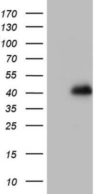 Western Blot: GLI4 Antibody (OTI3A9) [NBP2-45874]