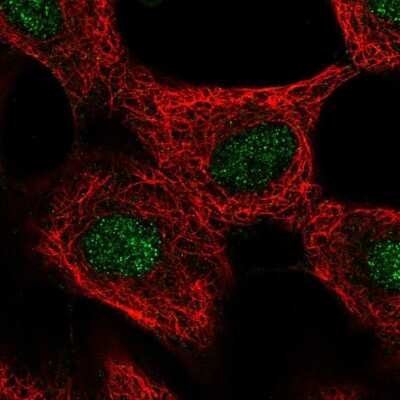 Immunocytochemistry/ Immunofluorescence: GLI4 Antibody [NBP2-14053]