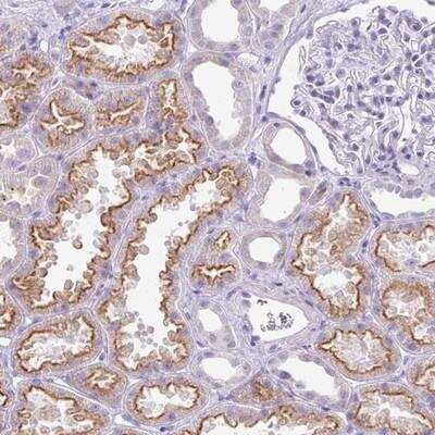 Immunohistochemistry: GLI4 Antibody [NBP2-14053]