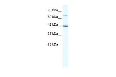 Western Blot: GLI4 Antibody [NBP2-84973]