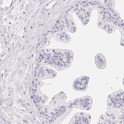 Immunohistochemistry-Paraffin: GLIPR1L1 Antibody [NBP1-82722]