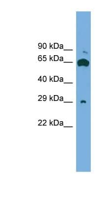 Western Blot: GLIPR1L1 Antibody [NBP1-57060]