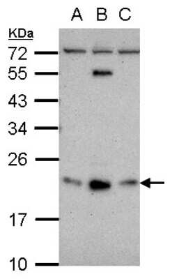 Western Blot: GLIPR1L1 Antibody [NBP2-16666]