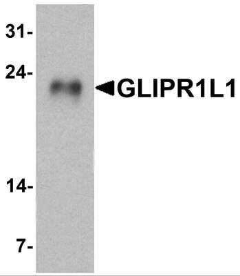 Western Blot: GLIPR1L1 AntibodyBSA Free [NBP2-81989]