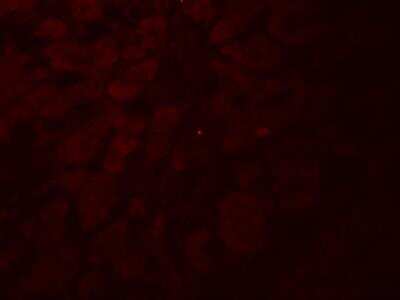 Immunocytochemistry/ Immunofluorescence: GLIPR1L2 Antibody - BSA Free [NBP2-82092]