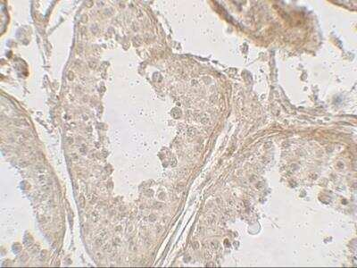 Immunohistochemistry: GLIPR1L2 Antibody - BSA Free [NBP2-82092]