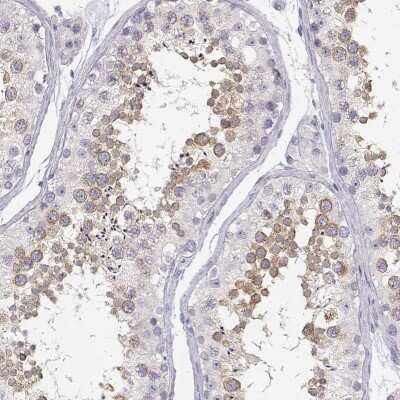 Immunohistochemistry-Paraffin: GLIPR1L2 Antibody [NBP1-81091]