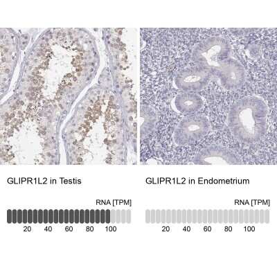 Immunohistochemistry-Paraffin: GLIPR1L2 Antibody [NBP1-81091]