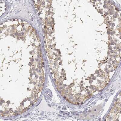 Immunohistochemistry-Paraffin: GLIPR1L2 Antibody [NBP1-81092]