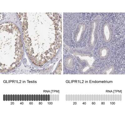 Immunohistochemistry-Paraffin: GLIPR1L2 Antibody [NBP1-81092]