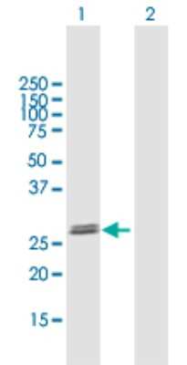 Western Blot: GLIPR1L2 Antibody [H00144321-B01P]