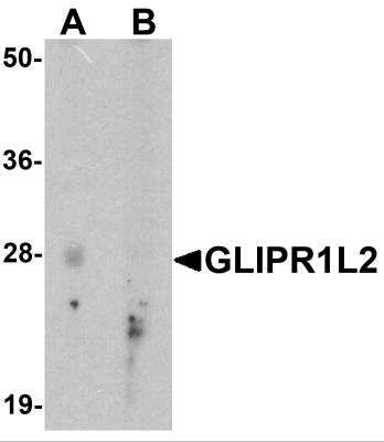 Western Blot: GLIPR1L2 AntibodyBSA Free [NBP2-82092]