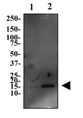 Western Blot: GLIPR2 AntibodyBSA Free [NBP2-47126]