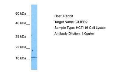 Western Blot: GLIPR2 Antibody [NBP2-84977]