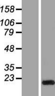 Western Blot: GLIPR2 Overexpression Lysate [NBP2-06449]