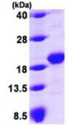 SDS-PAGE: Recombinant Human GLIPR2 His Protein [NBP1-48339]