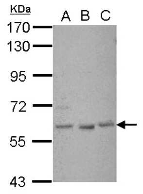 Western Blot: Glis1 Antibody [NBP2-16667]