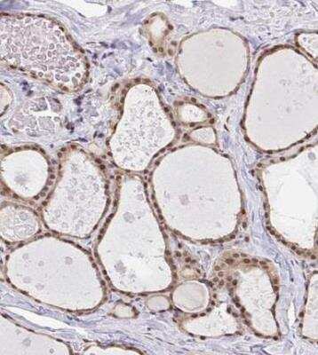 Immunohistochemistry-Paraffin: GLIS3 Antibody [NBP2-33787]