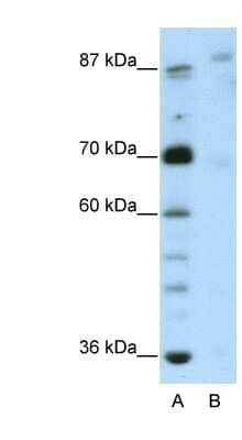 Western Blot: GLIS3 Antibody [NBP1-80416]