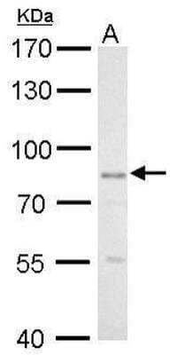 Western Blot: GLIS3 Antibody [NBP2-16668]