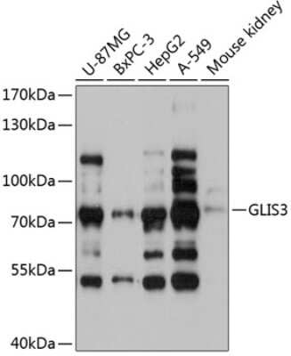 Western Blot: GLIS3 AntibodyAzide and BSA Free [NBP3-05128]