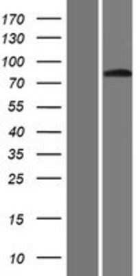 Western Blot: GLIS3 Overexpression Lysate [NBP2-05335]