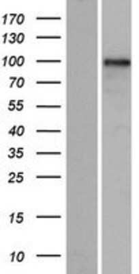 Western Blot: GLIS3 Overexpression Lysate [NBP2-08361]