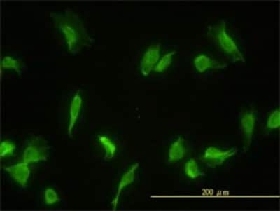 Immunocytochemistry/ Immunofluorescence: GLMN Antibody (1C12) [H00011146-M01]